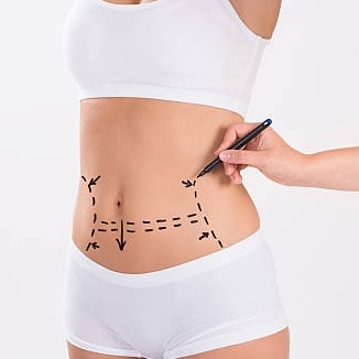 Liposuction  In Riyadh