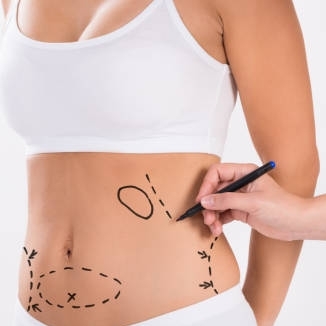 Liposuction  in Riyadh