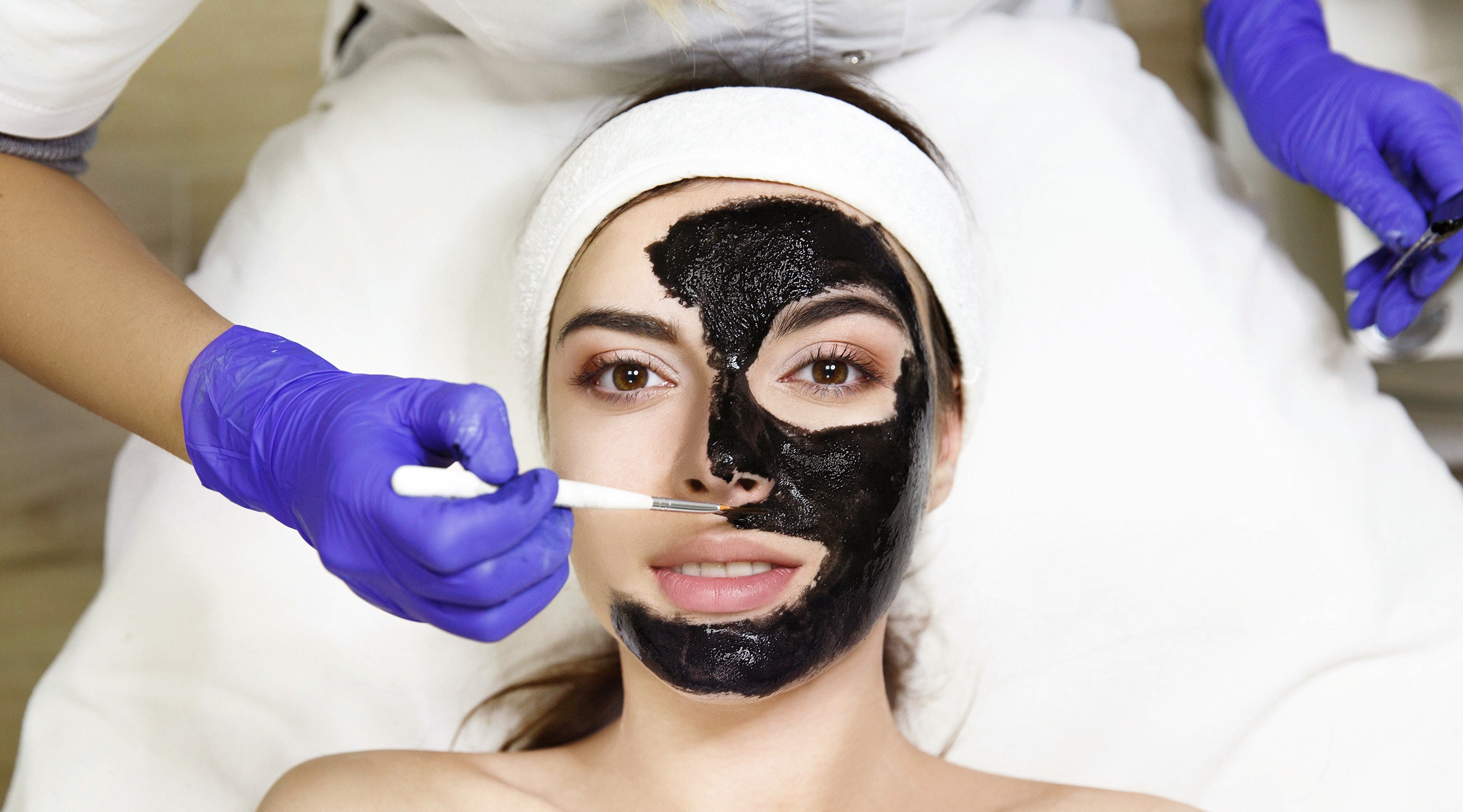 Laser Carbon Peel for Sensitive Skin: Is It Safe?