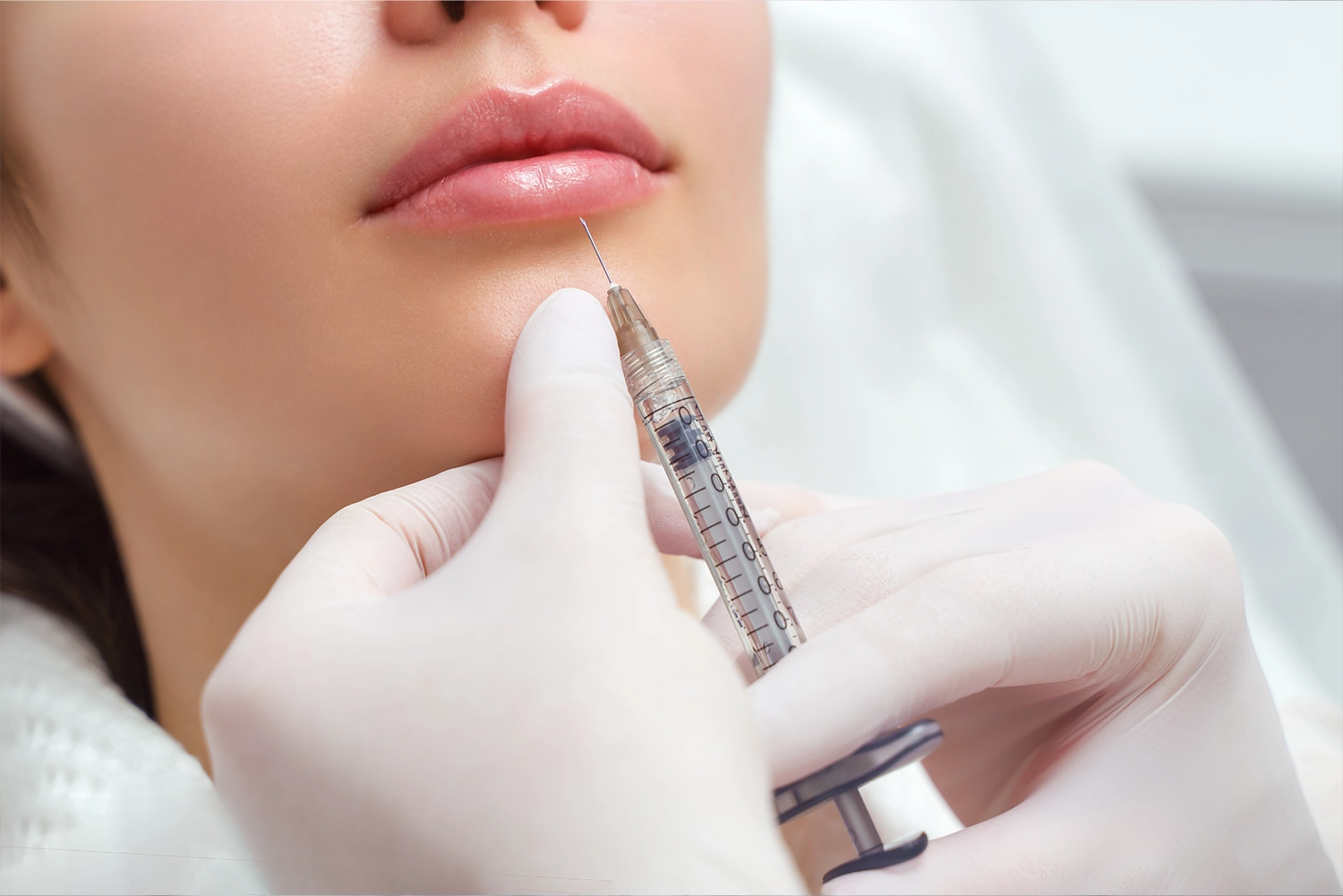 Before and After Lip Fillers: Realistic Expectations for Clients