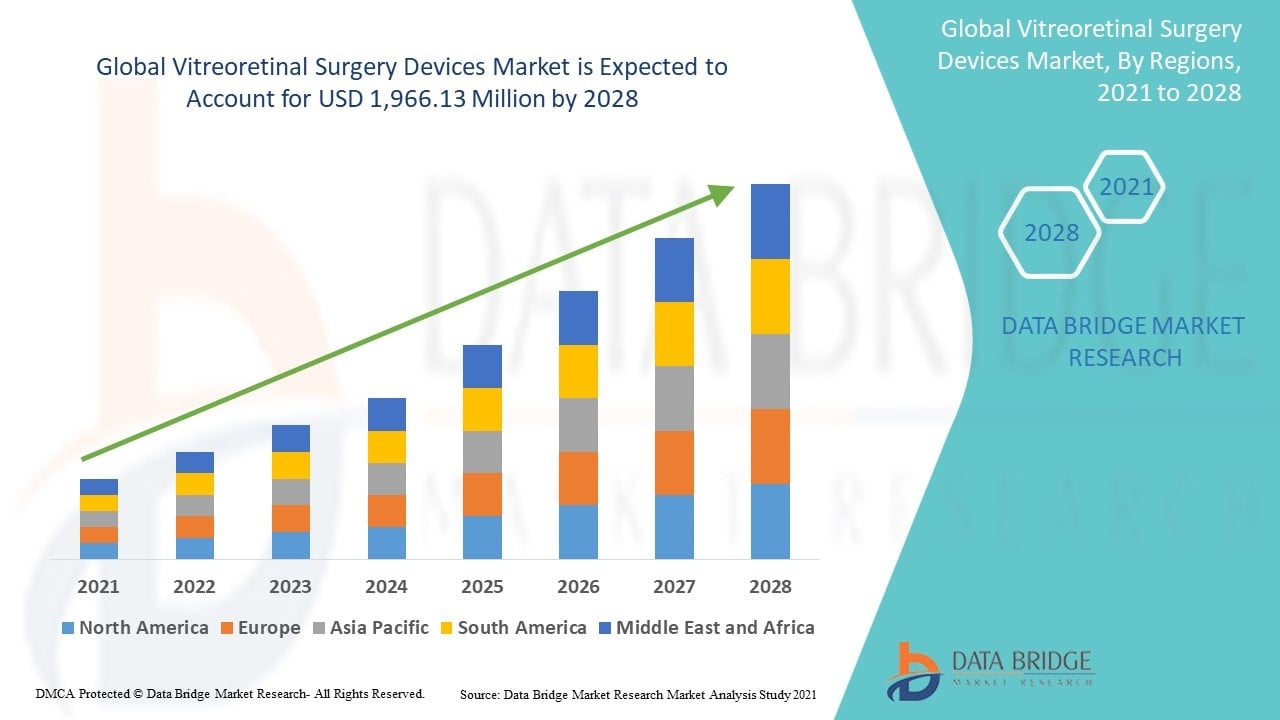 Vitreoretinal Surgery Devices Market Industry Overview and Forecast to 2031 &ndash; Market Analysis and Market Share
