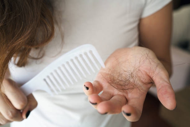 How Exercise Supports Healthy Hair Growth and Reduces Hair Loss