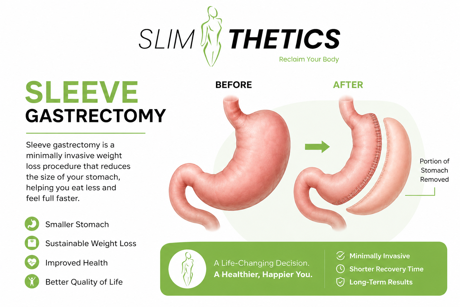Recovering After Sleeve Gastrectomy in Islamabad: A Week-by-Week Recovery Timeline