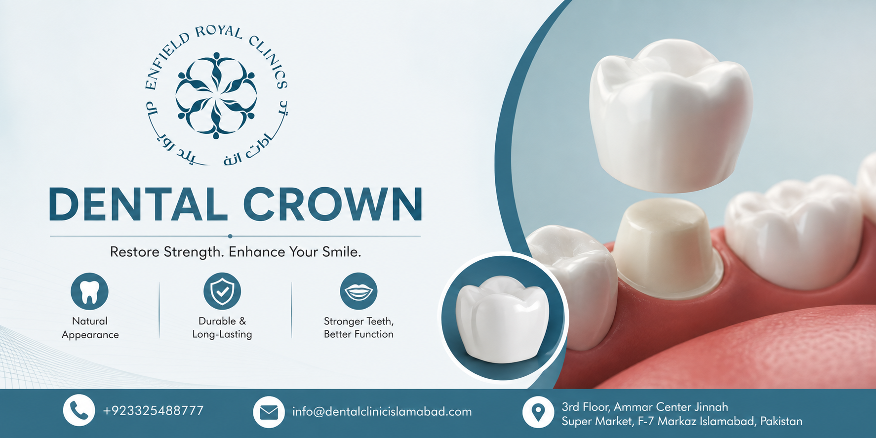 Smile Restoration With Dental Crowns in Islamabad